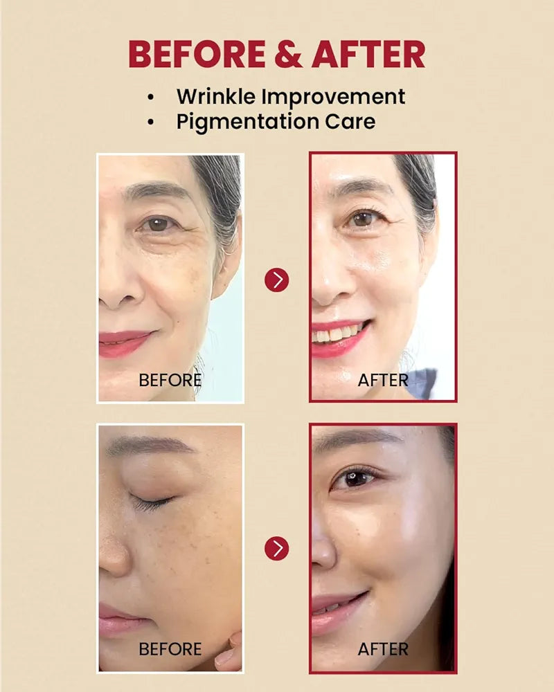 SEOUL 1988 Retinal Serum: 2% Retinal Liposome