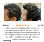 Raw Batana Oil for Hair Growth - 100% Pure, Organic 4oz Batana from Honduras for Thick and Strong Natural Hair - Dr. Sebi Unrefined Cold Pressed Cosmetic Scalp Mask for Men & Women (1 Pack)