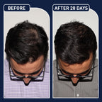 FEG Plus Hair Growth Spray 45% Off Limited Offer