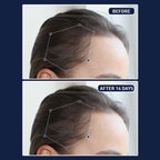FEG Plus Hair Growth Spray 45% Off Limited Offer