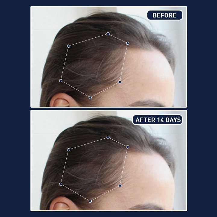 FEG Plus Hair Growth Spray 45% Off Limited Offer